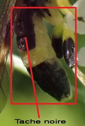 Zonuledo zonula